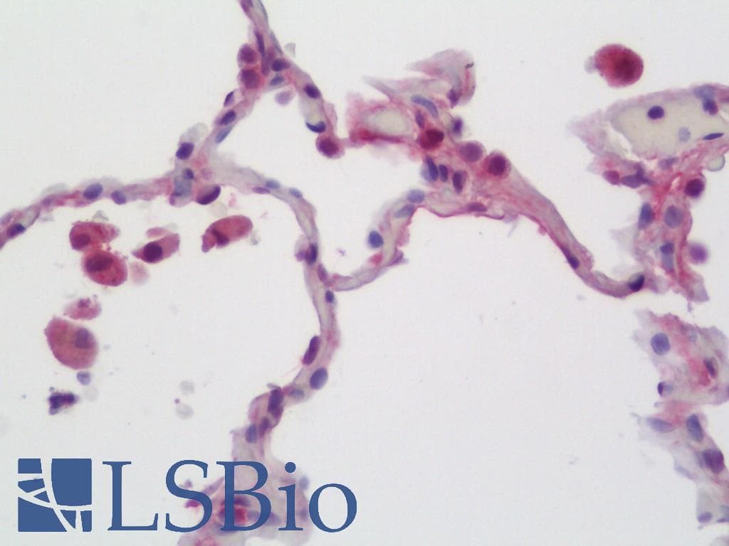 IHC-plus™ Polyclonal Rabbit anti-Human CCL3 / MIP-1-Alpha Antibody (aa26-75, IHC)