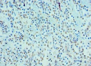 Polyclonal Rabbit anti-Human CRY2 Antibody (aa434-593, IHC, WB)