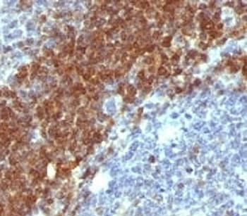 BCL2 / Bcl-2 Antibody (aa41-54, clone SPM530)