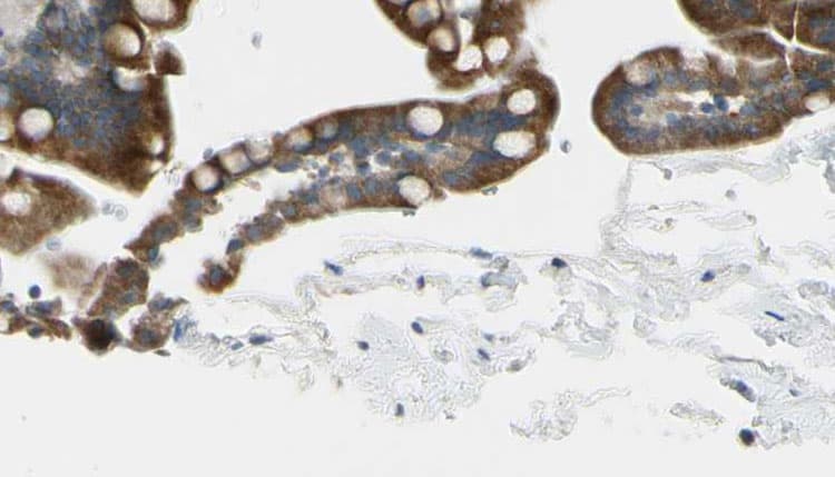 Polyclonal Rabbit anti-Human CRHR2 / CRF2 Receptor Antibody (IHC, IF, WB)