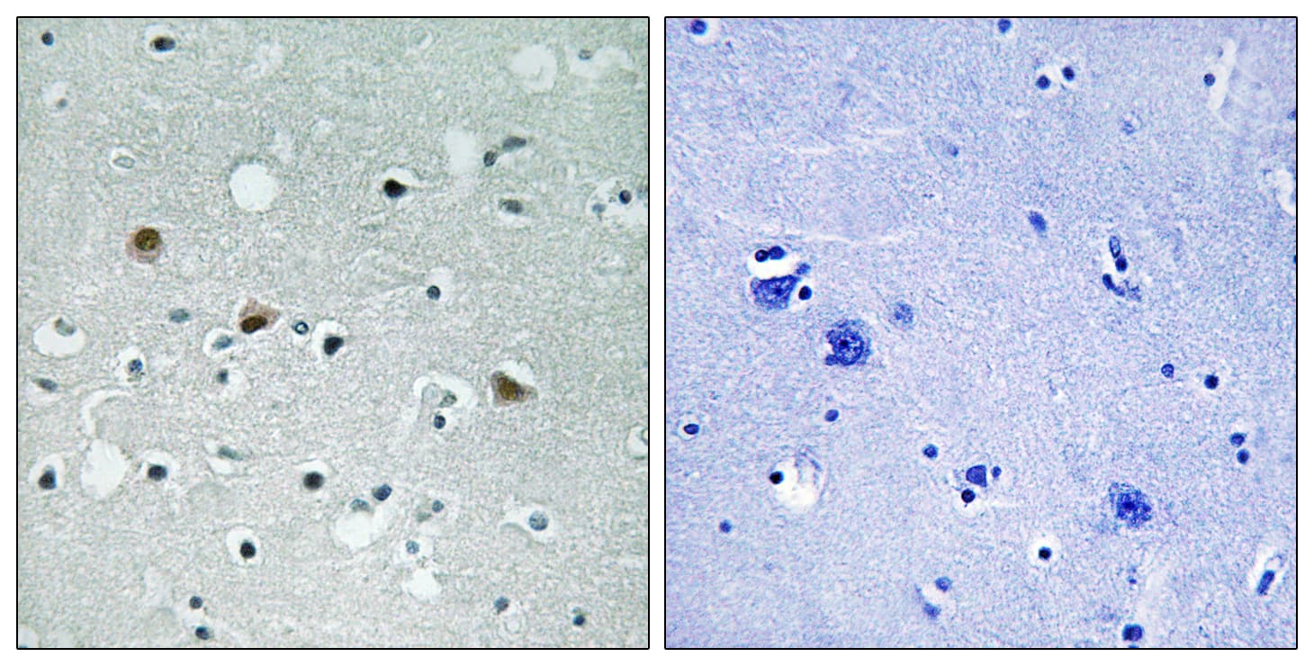 LATS1 + LATS2 Antibody (phospho-Thr1079/Thr1041)