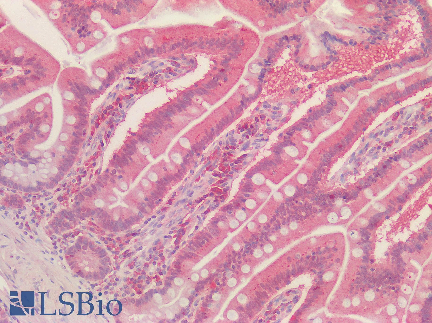 IHC-plus™ PRDX1 / Peroxiredoxin 1 Antibody (aa106-117)