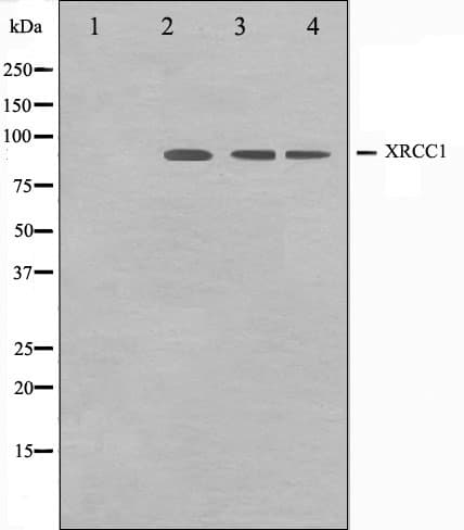 Polyclonal Rabbit anti-Human XRCC1 Antibody (IHC, WB)