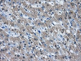 Monoclonal Mouse anti-Human AKR1A1 Antibody (clone OTI8H2, IHC, WB)