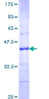 Human CDH18 / Ey-Cadherin Protein (Recombinant GST, N-terminus)