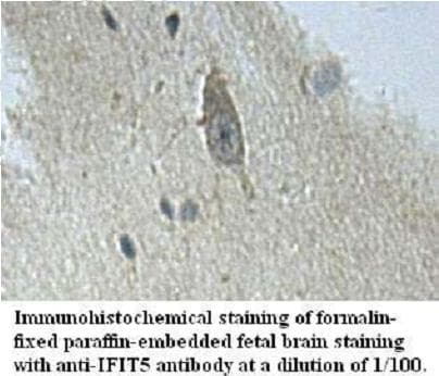Polyclonal Rabbit anti-Human IFIT5 Antibody (aa79-294, IHC, WB)