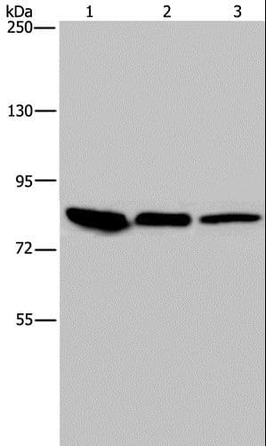 JUP/CTNNG/Junction Plakoglobin Antibody