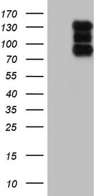 HDAC4 Antibody (clone OTI1C8)