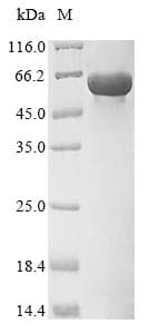 Mouse PKM / Pyruvate Kinase, Muscle Protein (Recombinant 10His, N-terminus + Myc, C-terminus)