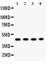 MBD2 Antibody (aa159-411)