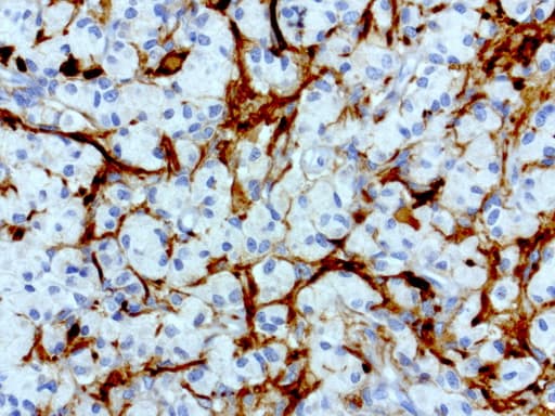L1CAM Antibody (clone UMAB47, Carrier-free)