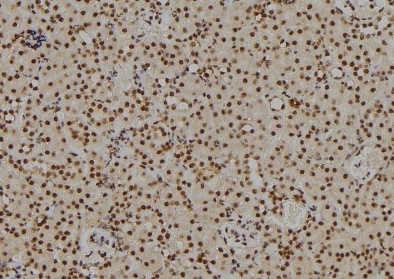 RB1 / Retinoblastoma / RB Antibody