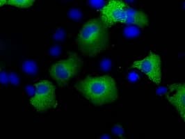 ERIC-1 / TACC3 Antibody (clone OTI1E4)