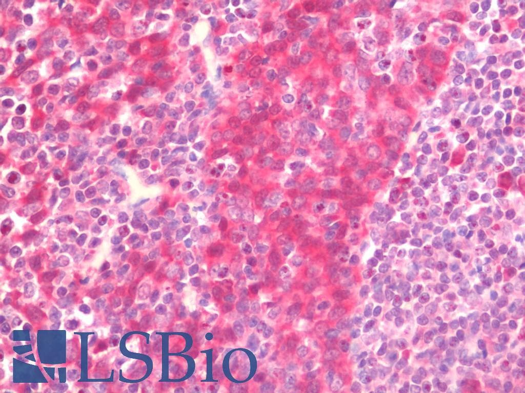 IHC-plus™ LTA / TNF Beta Antibody (aa17-66)