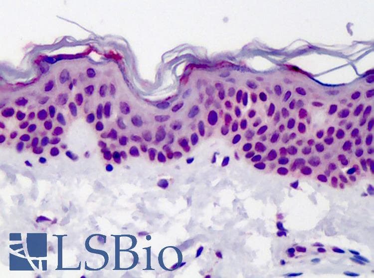Capicua / CIC Antibody (aa1500-1608, DY650)