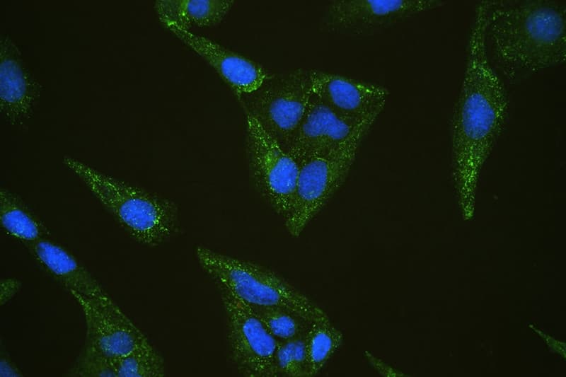 Polyclonal Rabbit anti-Human INPPL1 / SHIP2 Antibody (IHC, WB)