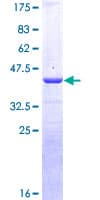 Human CALCA Protein (Recombinant GST)