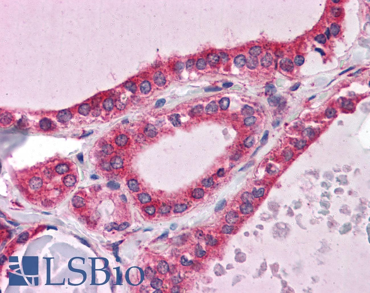 IHC-plus™ Polyclonal Rabbit anti-Human WDR35 Antibody (IHC)