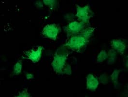 C1orf50 Antibody (clone OTI1B11)