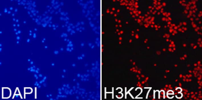 Histone H3 Antibody (Trimethyl-Lys27)