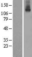 Human WC1 / ATP7B Protein (Over-Expression Lysate Myc-DDK (Flag))