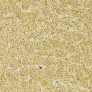 Polyclonal Rabbit anti-Human MLANA / Melan-A Antibody (IHC, IF, WB)