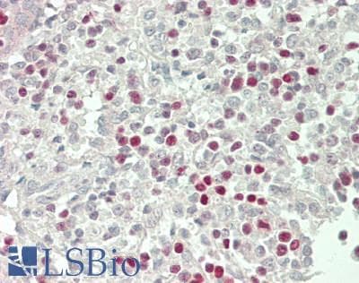 IHC-plus™ Polyclonal Rabbit anti-Human TBX21 / T-bet Antibody (IHC, WB)