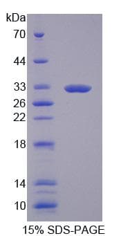 Human GBP3 Protein (Recombinant His, N-Terminal)