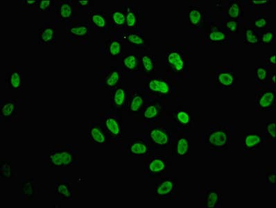 Polyclonal Rabbit anti-Human HIST1H4I Antibody (WB)
