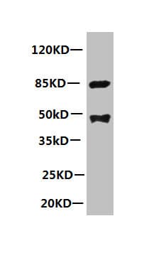 LP-PLA2 / PLA2G7 Antibody (clone 2A1B6)