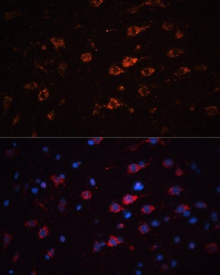 TH / Tyrosine Hydroxylase Antibody