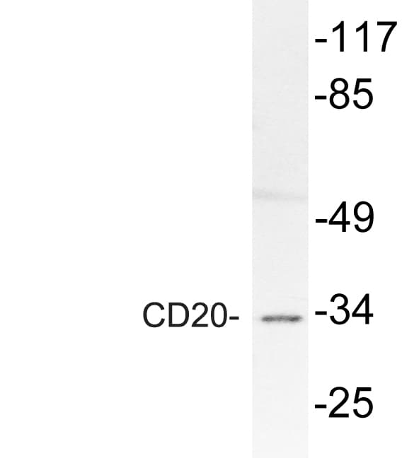 CD20 Antibody (aa181-230)