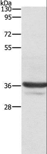 Polyclonal Rabbit anti-Human ANXA3 / Annexin A3 Antibody (IHC, WB)