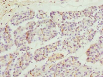 Polyclonal Rabbit anti-Human ZFYVE1 / DFCP1 Antibody (IHC, WB)