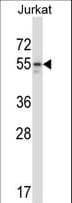 IHC-plus™ MAP2K7 / MEK7 Antibody (aa206-233)