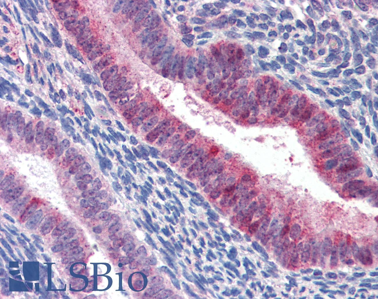 IHC-plus™ SCGB2A2 / Mammaglobin A Antibody (aa34-45)
