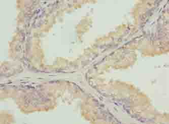Polyclonal Rabbit anti-Human TUBB1 / Tubulin Beta 1 Antibody (IHC, WB)