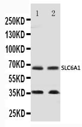 SLC6A1 / GAT-1 Antibody (aa473-487)