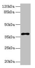 Polyclonal Rabbit anti-Human POLB / DNA Polymerase Beta Antibody