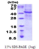 Human APMAP / C20orf3 Protein (Recombinant His)