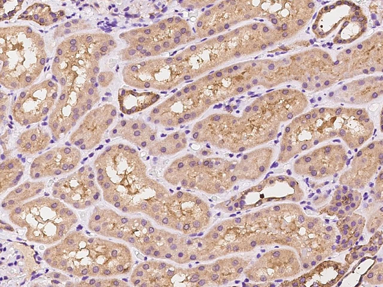 CCDC91 Antibody