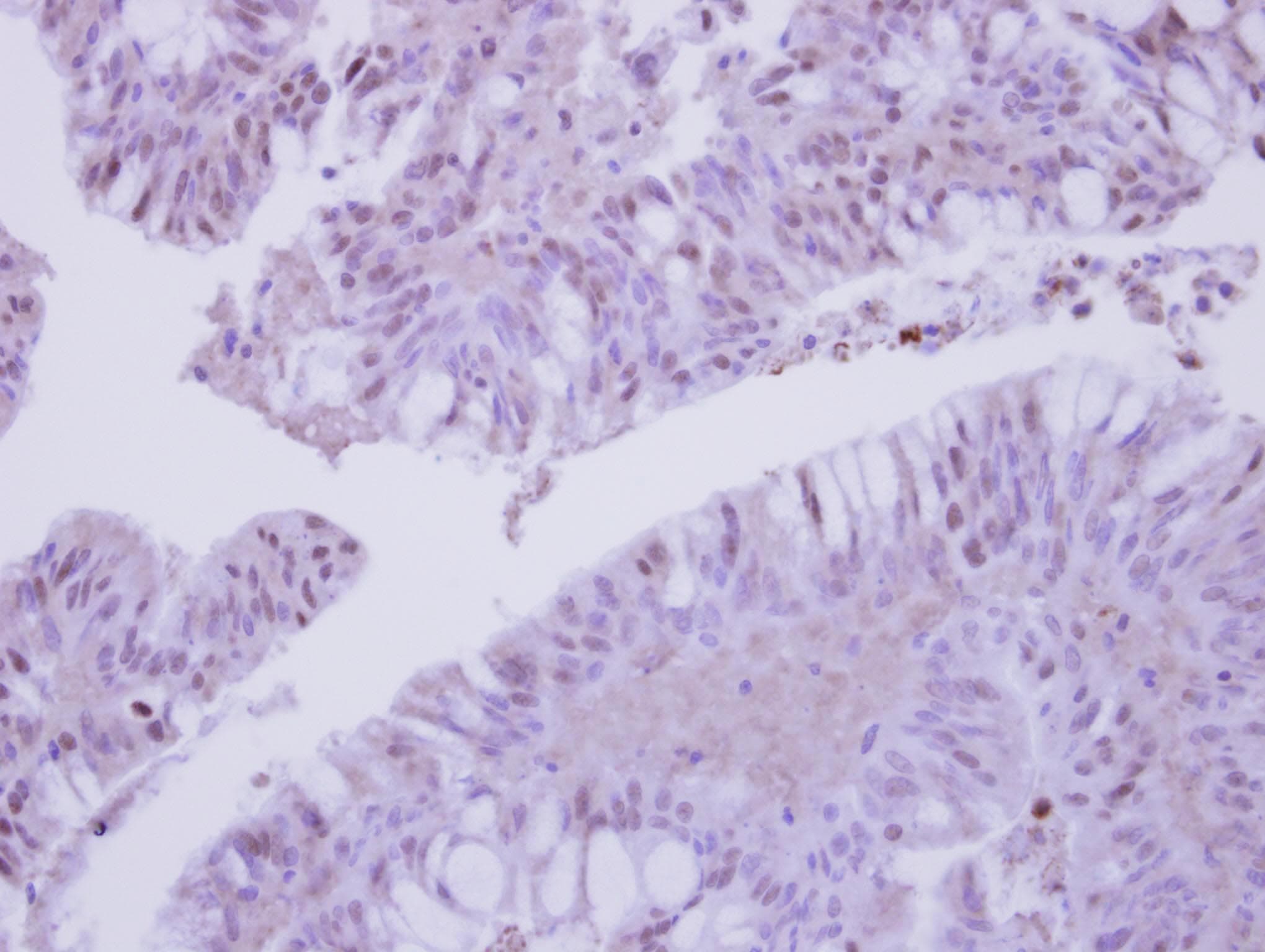 COPS3 / CSN3 Antibody