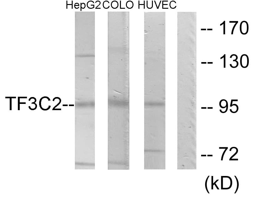 GTF3C2 Antibody (aa71-120)
