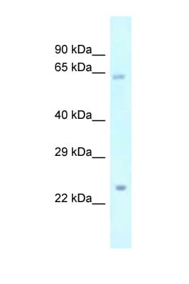 Polyclonal Rabbit anti-Mouse Catip / Gm216 Antibody (aa320-369, WB)