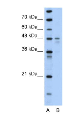 PDK4 Antibody (N-Terminus)