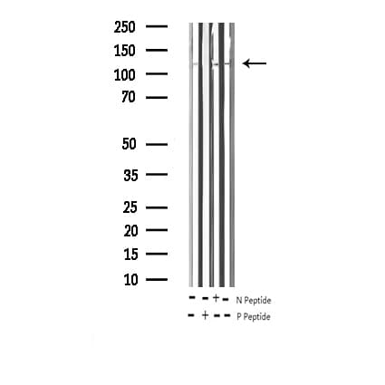 FAK / Focal Adhesion Kinase Antibody (phospho-Tyr861)