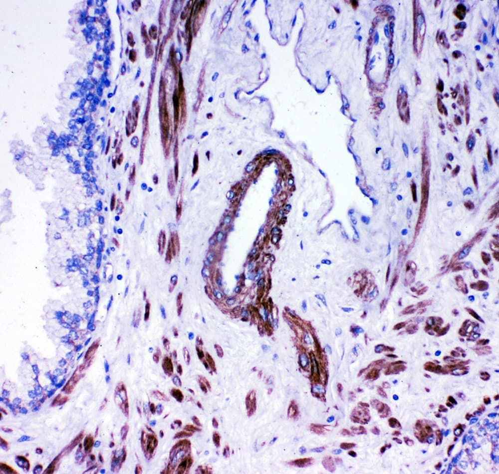 ACE / CD143 Antibody (aa702-715)