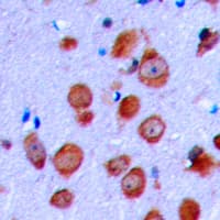 Polyclonal Rabbit anti-Human CFTR Antibody (aa716-755, IHC, WB)