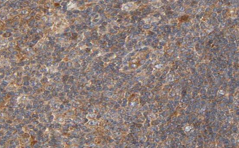 Polyclonal Rabbit anti-Human CIB2 / KIP2 Antibody (IHC, IF, WB)
