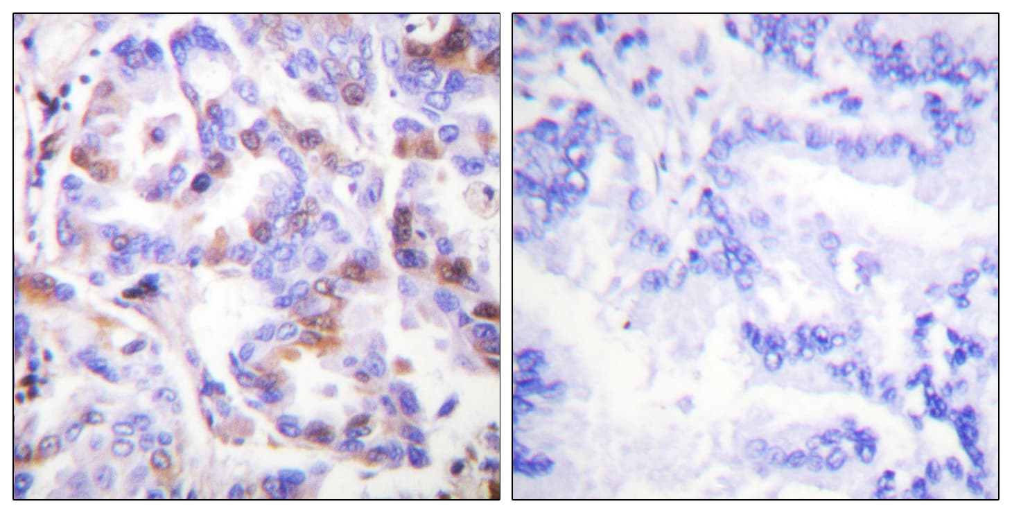 RPA2 / RFA2 / RPA34 Antibody (phospho-Thr21)